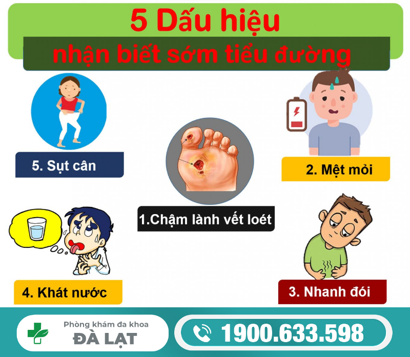 Hình ảnh minh họa